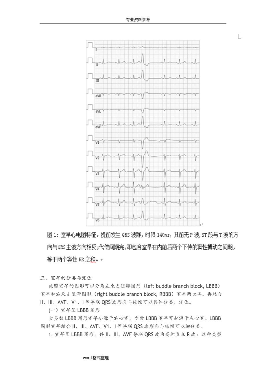 室性早搏的心电图特点、分类、危险分层与临床处理_第2页