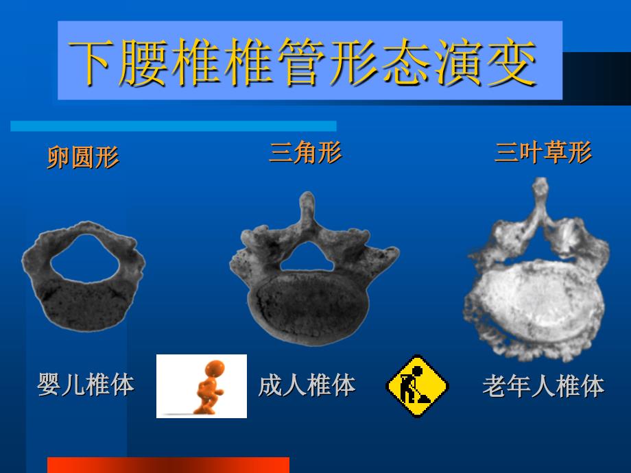 颈椎病及下腰痛课件_第4页