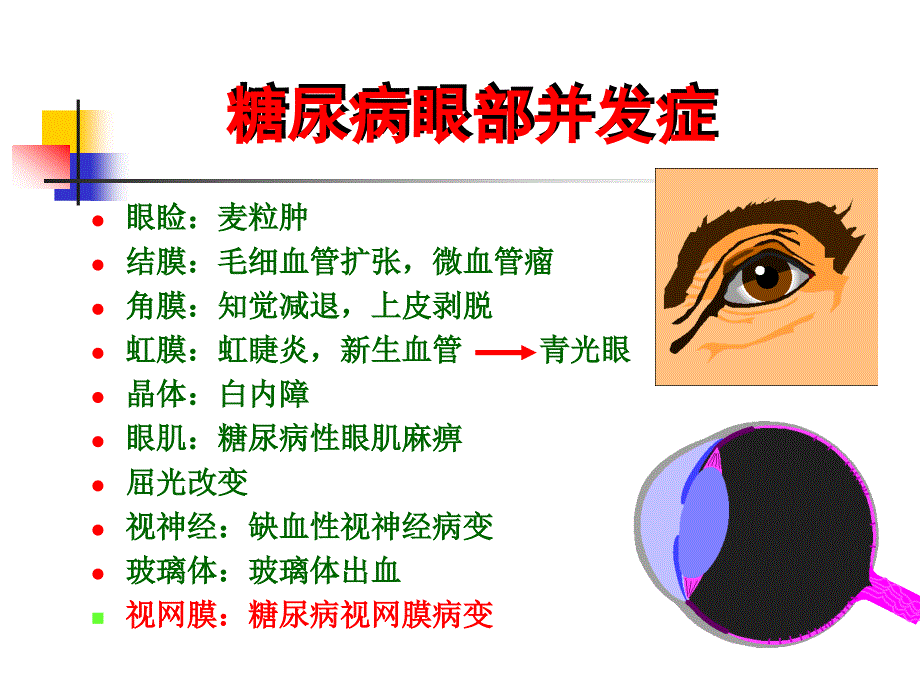 医学专题：糖尿病视网膜病变1_第2页