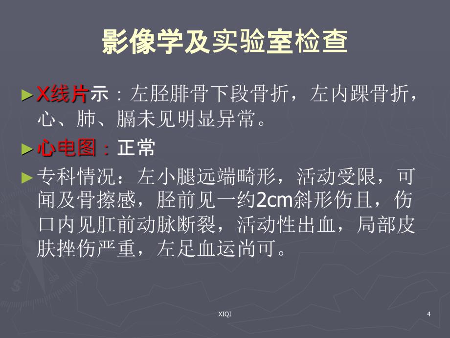 胫腓骨骨折护理查房me_第4页