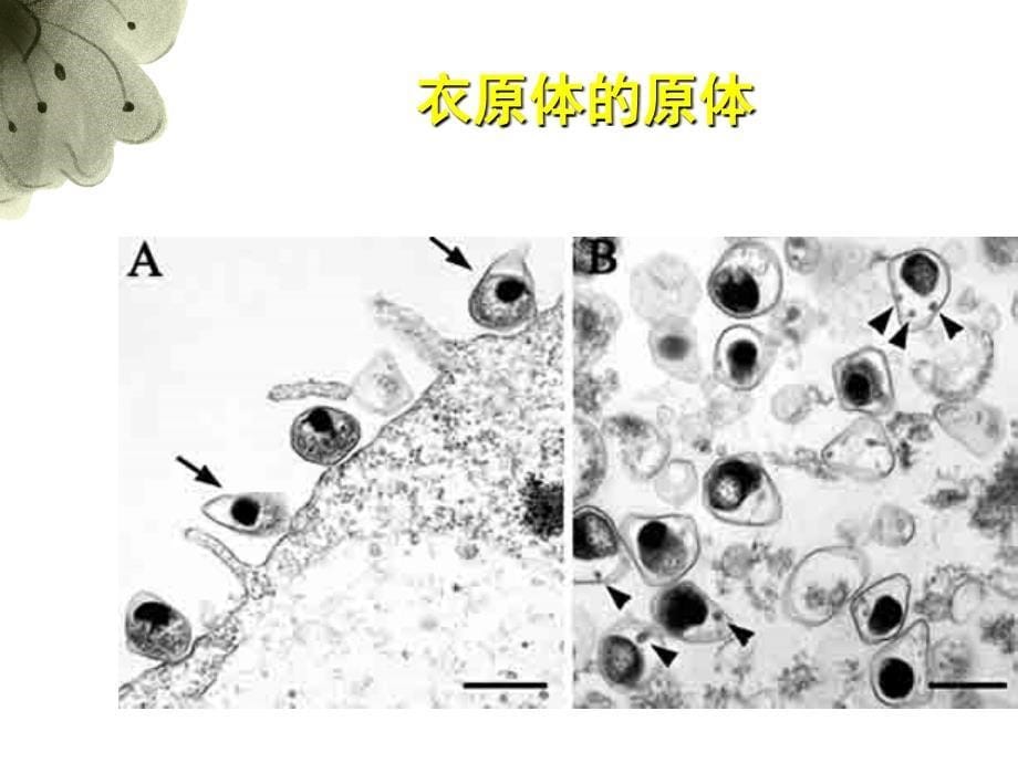 衣原体病专题ppt课件_第5页