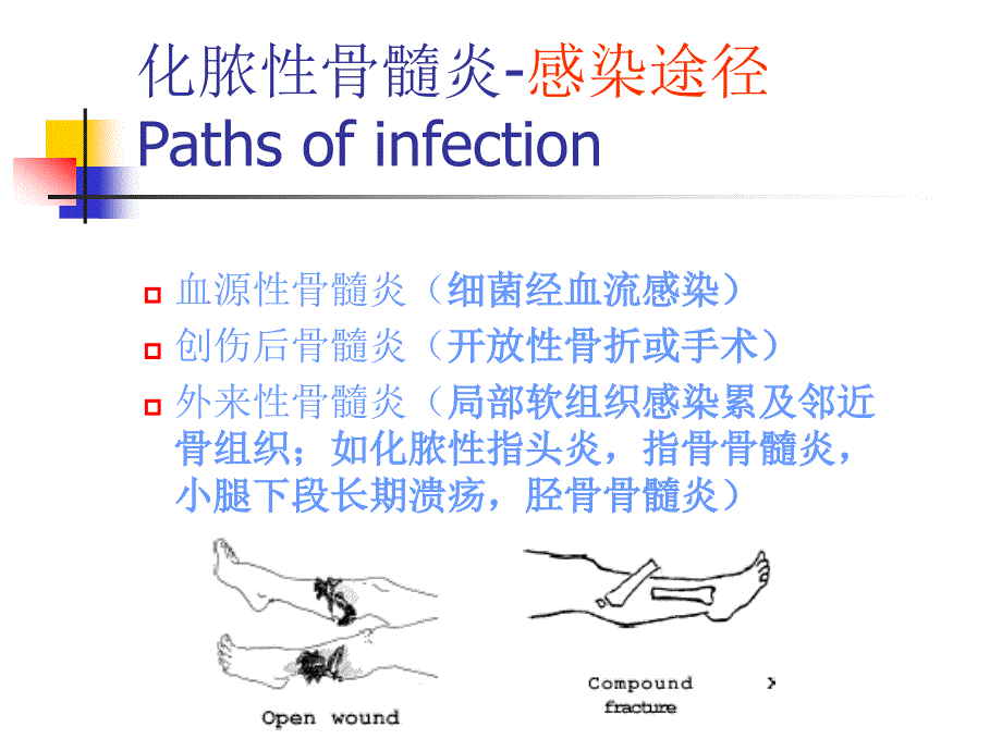 骨与关节化脓性感染课件_第4页