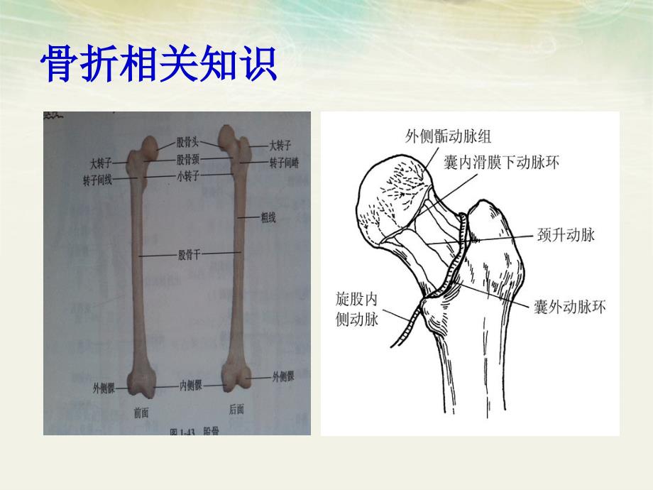 一例股骨颈骨折的康复护理查房_第3页