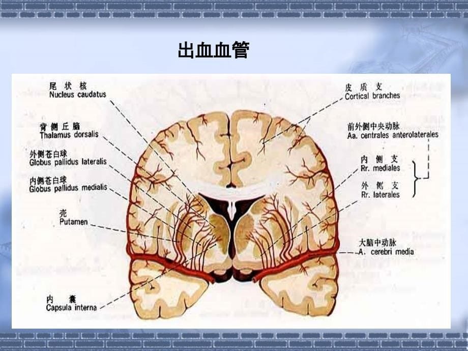 脑出血诊疗规范_第5页