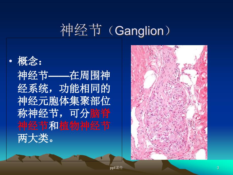 嗜铬细胞瘤-(影像)--课件_第3页