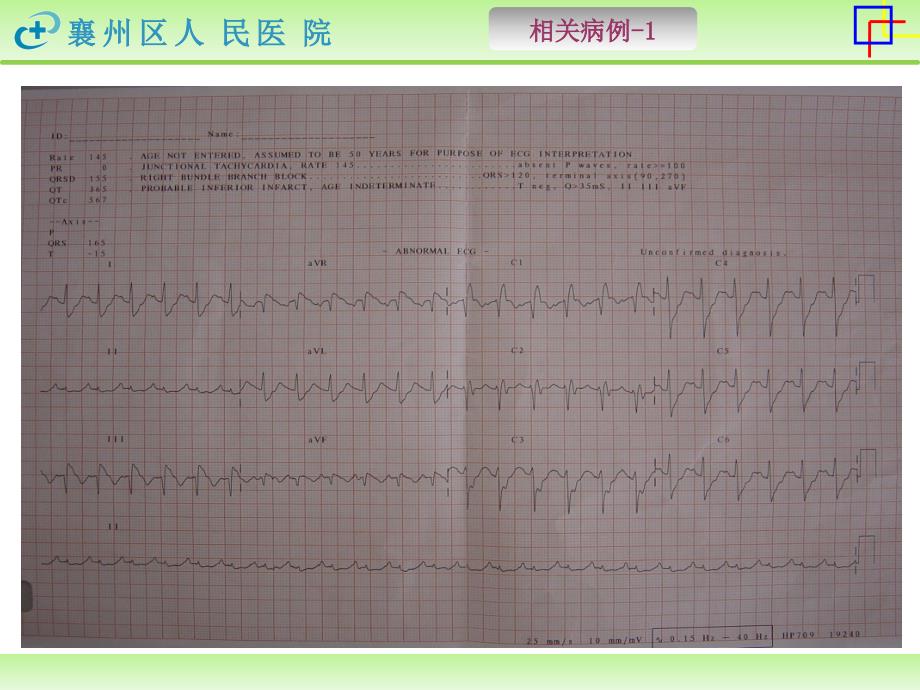 肺栓塞定稿28(是修改)_第3页