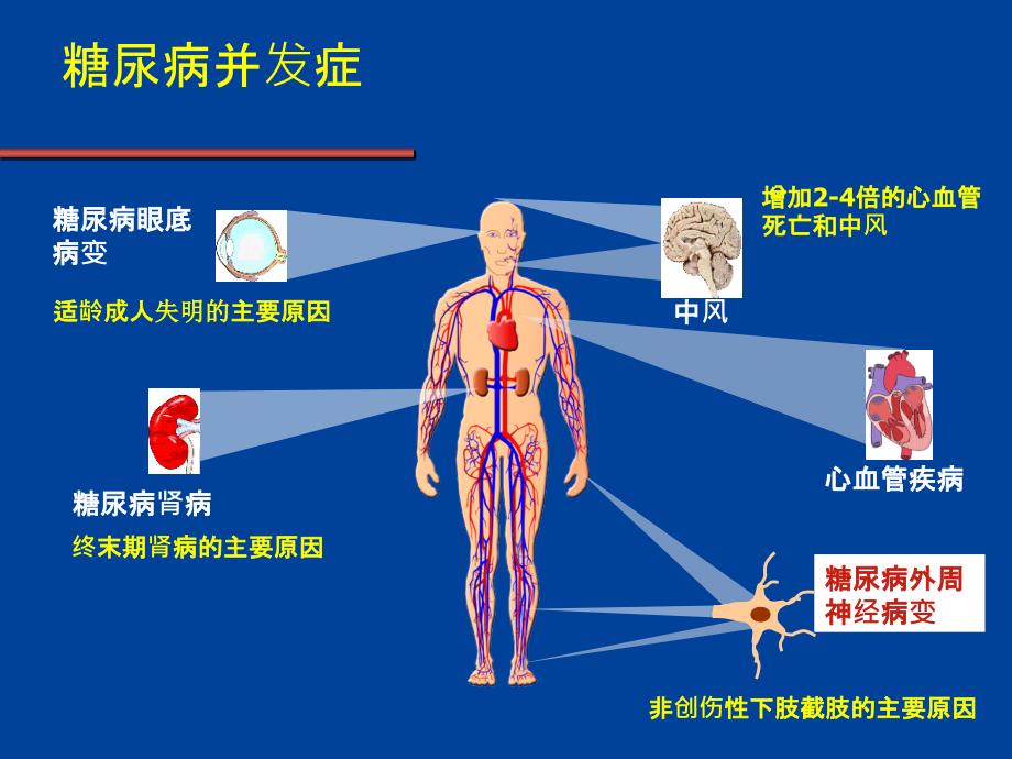 糖尿病痛性神经病变的发病机制和治疗_第4页