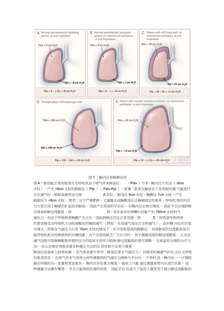 NEJM-呼吸机相关性肺损伤_第2页