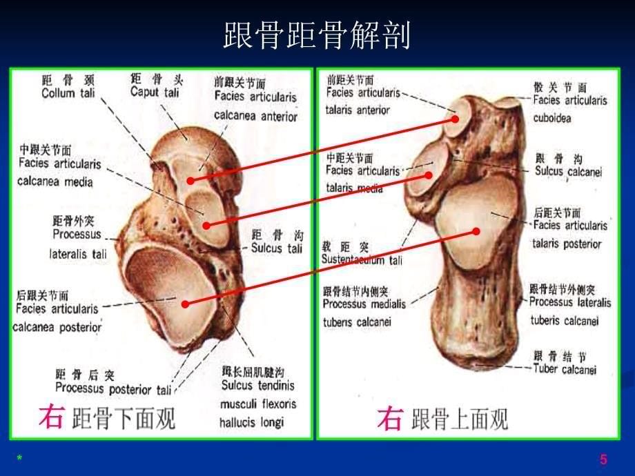 跗骨窦综合征影像诊断_第5页