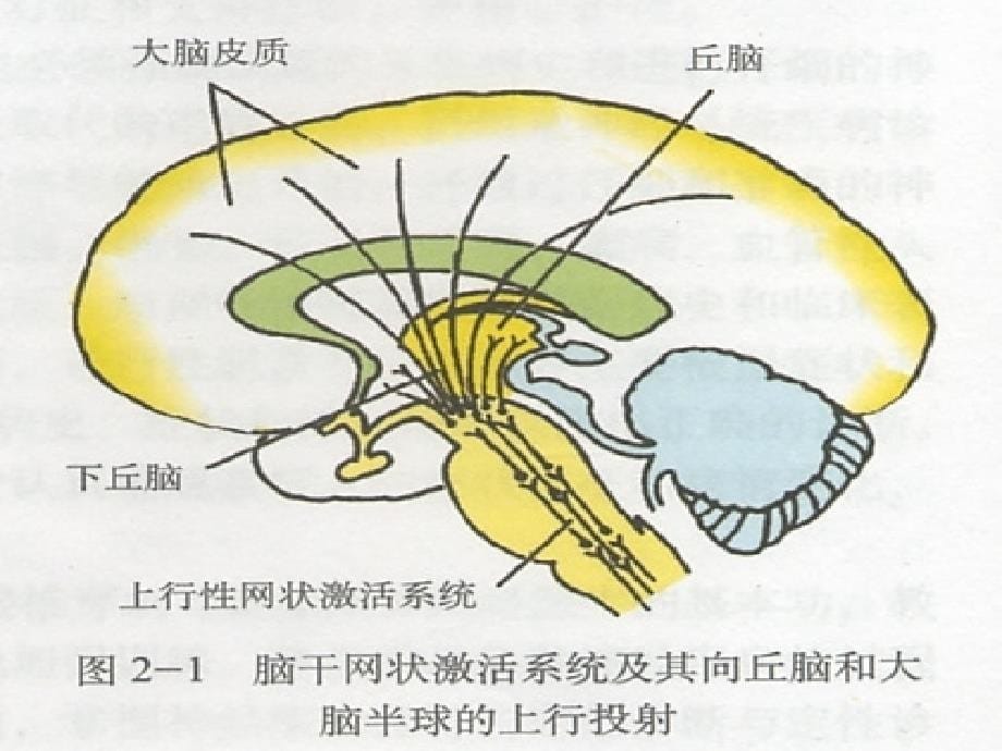 昏迷的鉴别诊断PPT课件02_第5页