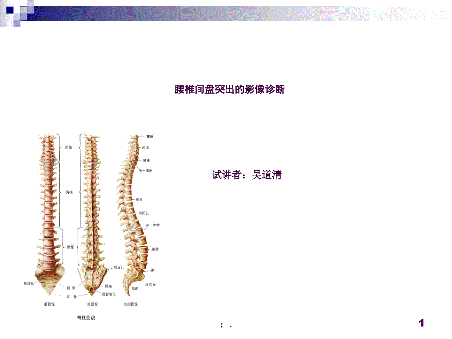 腰椎间盘突出的影像诊断ppt课件_第1页