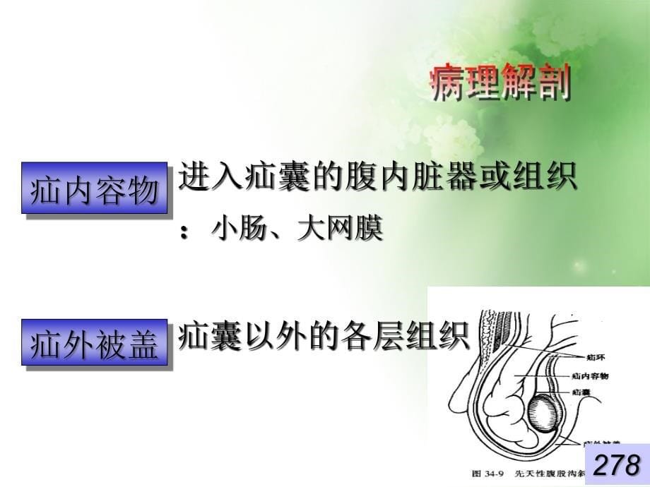 腹外疝教学课件_第5页