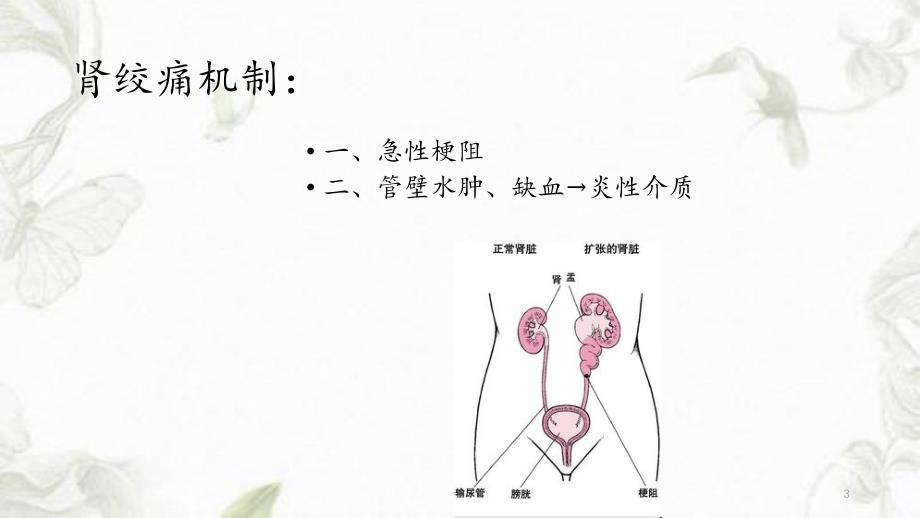 泌尿外科常见急症及处理_第3页