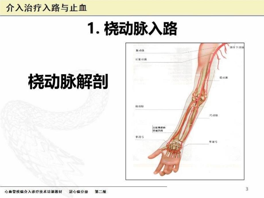 介入治疗穿刺技术知识分享_第3页