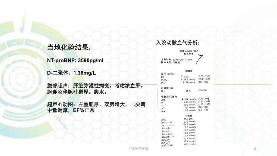 淀粉样变性心肌病课件_第5页