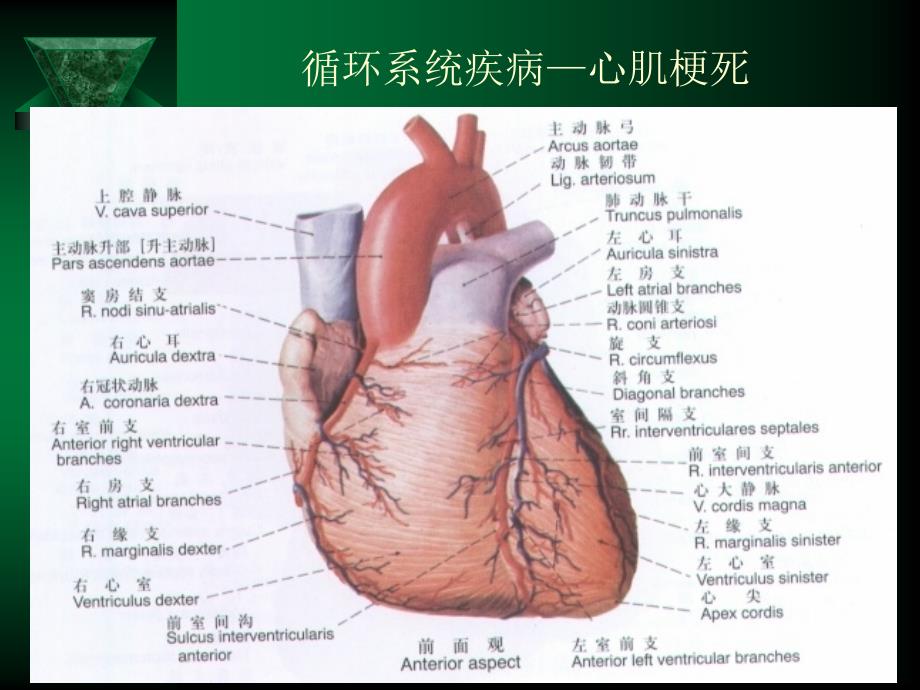 循环系统疾病—心肌梗死文档资料_第4页