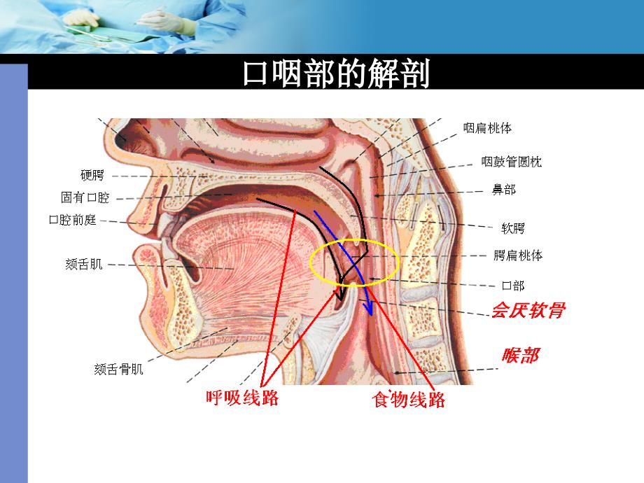 口咽通气道的使用.ppt_第2页