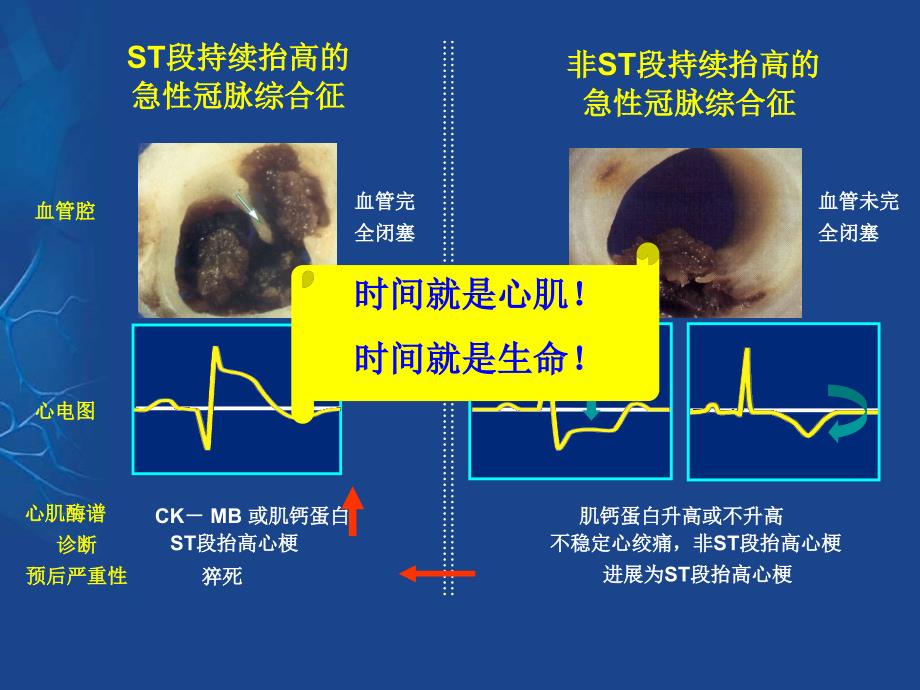 pci波立维ppt课件_第3页