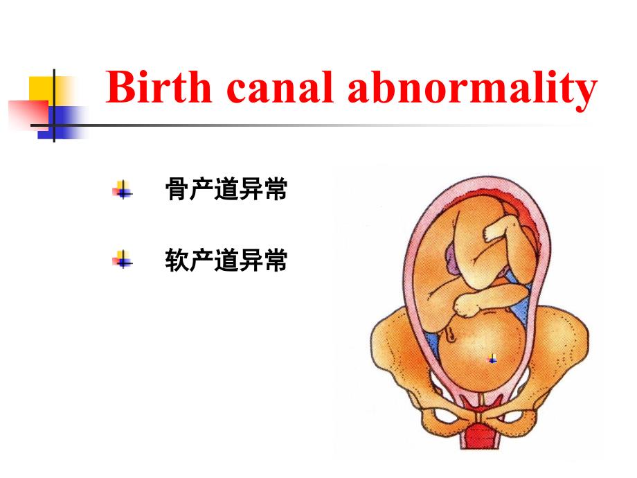 医学专题：坐骨棘间径8cm_第4页