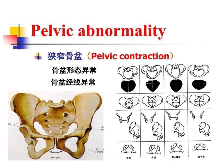 医学专题：坐骨棘间径8cm_第5页