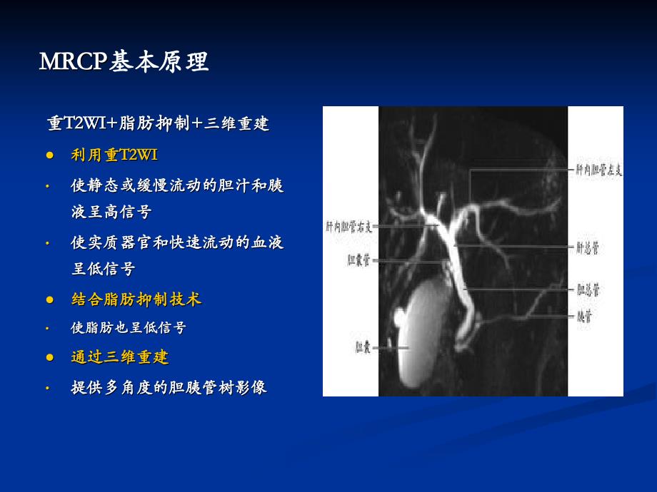 【精品文档值得】MRCP在临床的应用(实用)_第3页