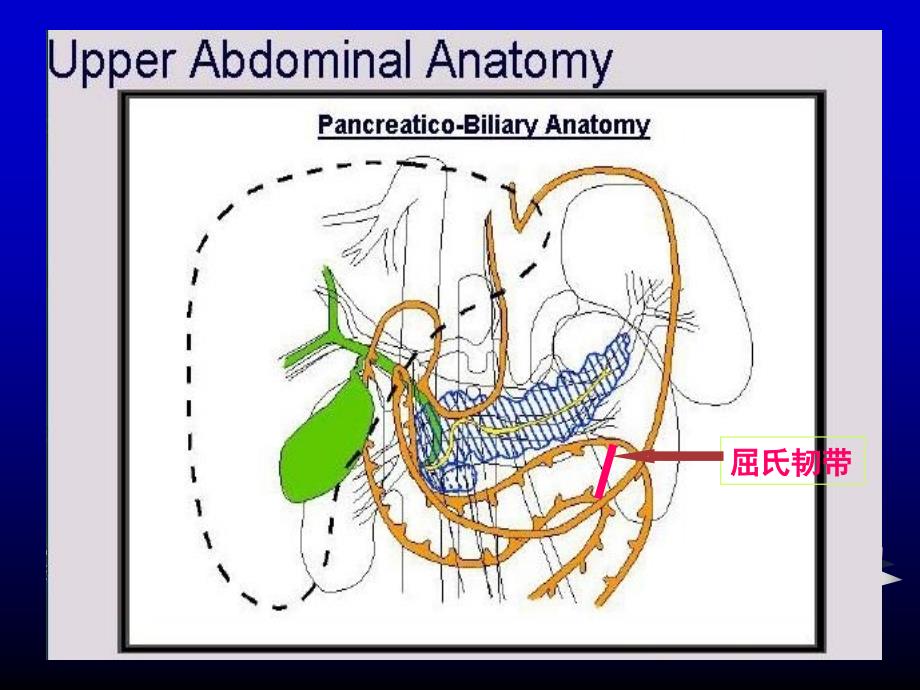 上消化道出血讲课课件_第3页