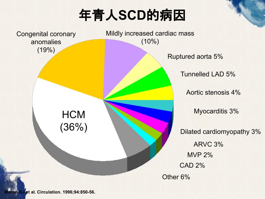 肥厚心肌病患者的ICD治疗_第3页