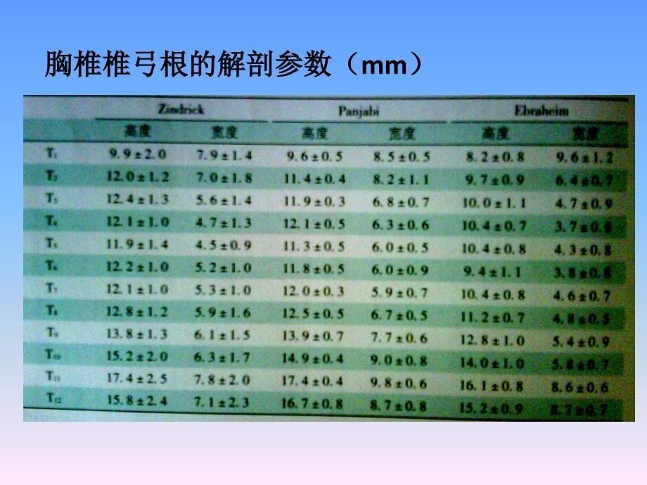 胸椎椎弓根解剖与临床_第5页