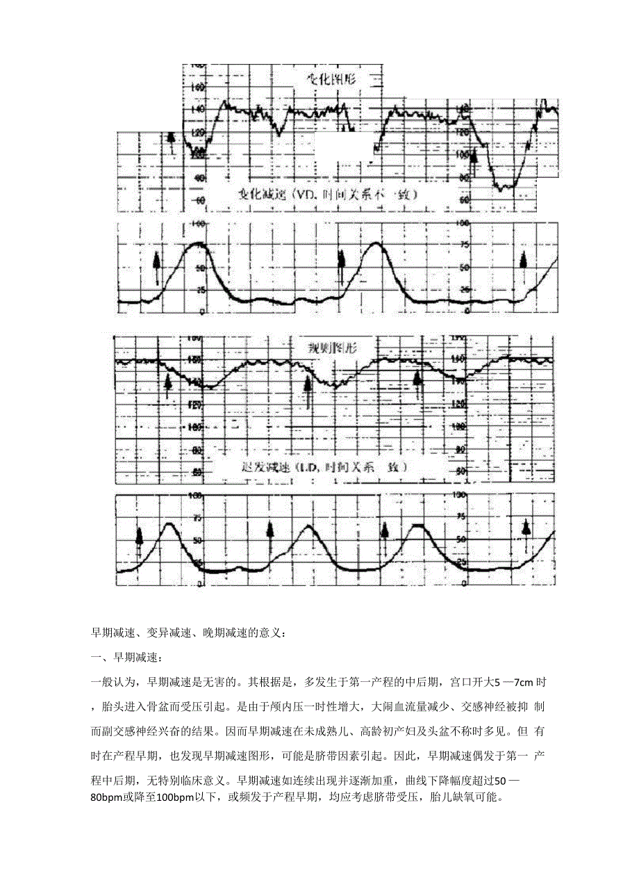 谈谈胎心监护_第4页