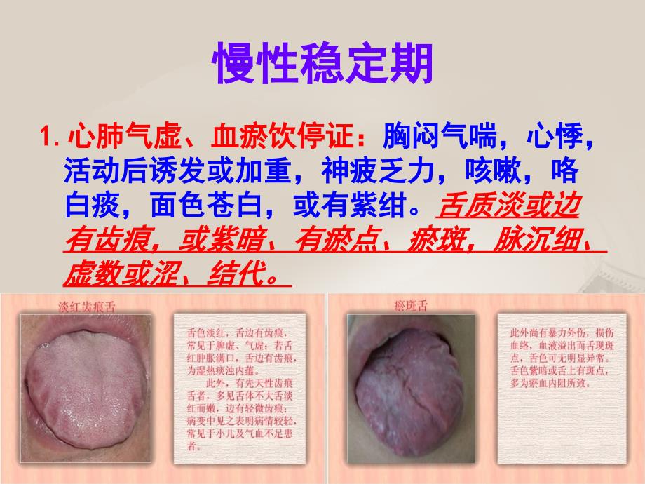 心衰病（心力衰竭）中医护理方案ppt_第4页