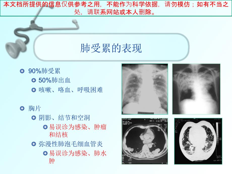 ANCA相关性小血管炎的诊治培训课件_第3页