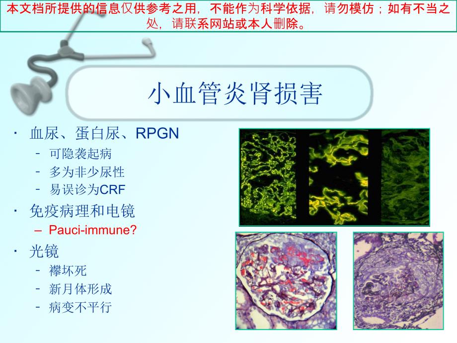 ANCA相关性小血管炎的诊治培训课件_第4页