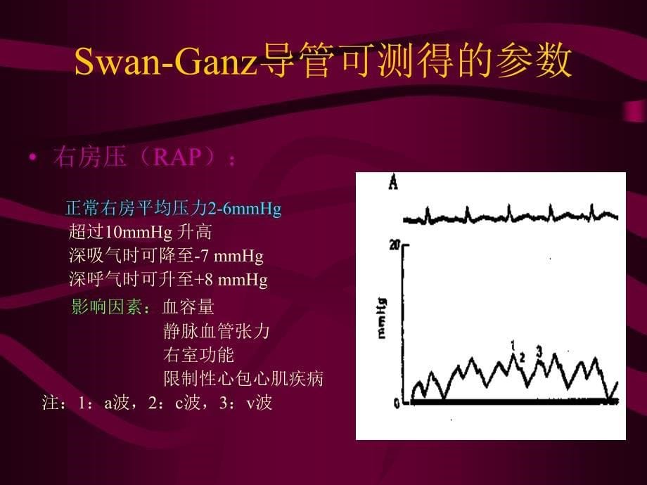 血液动力学监测ppt课件_第5页