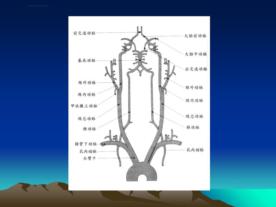 锁骨下动脉窃血ppt课件_第3页