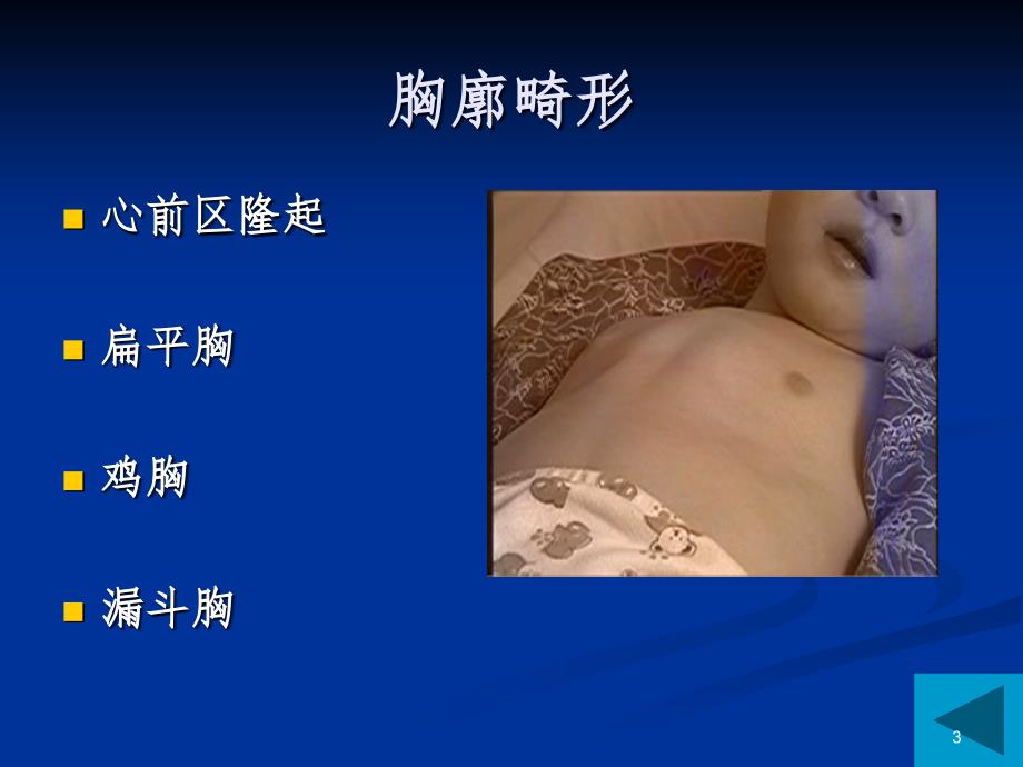 心血管体格检查.ppt_第3页