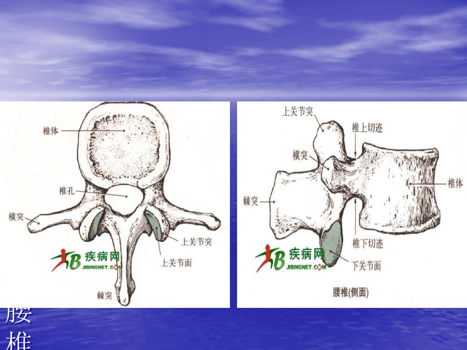 腰椎骨折病人的护理课件_第4页