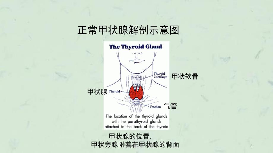 甲亢的特殊表现及处理课件_第2页