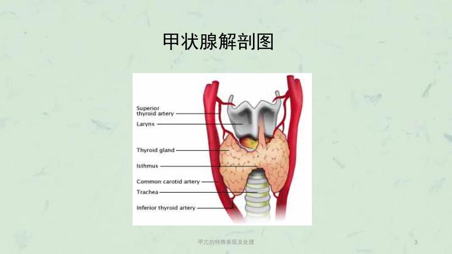 甲亢的特殊表现及处理课件_第3页