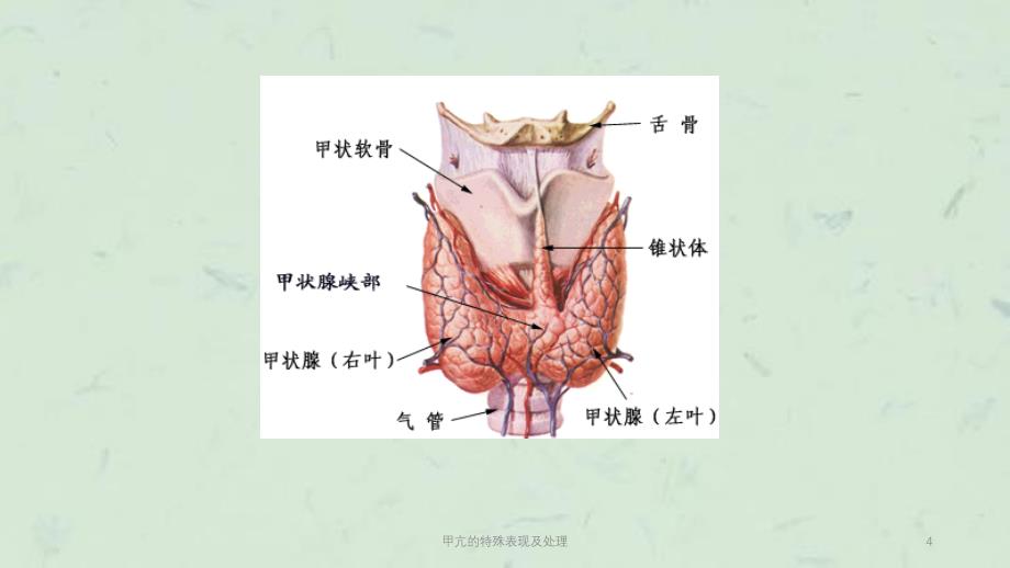 甲亢的特殊表现及处理课件_第4页