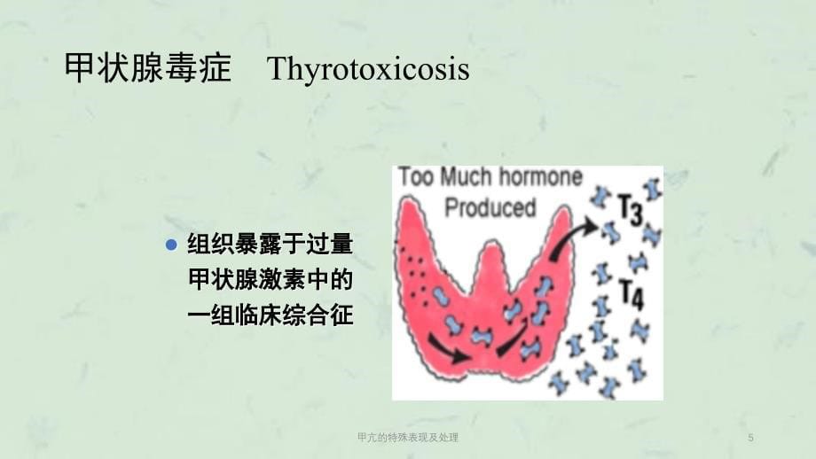 甲亢的特殊表现及处理课件_第5页