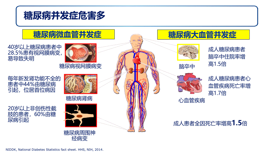 优质课件GLP1RA利拉鲁肽治疗2型糖尿病_第3页