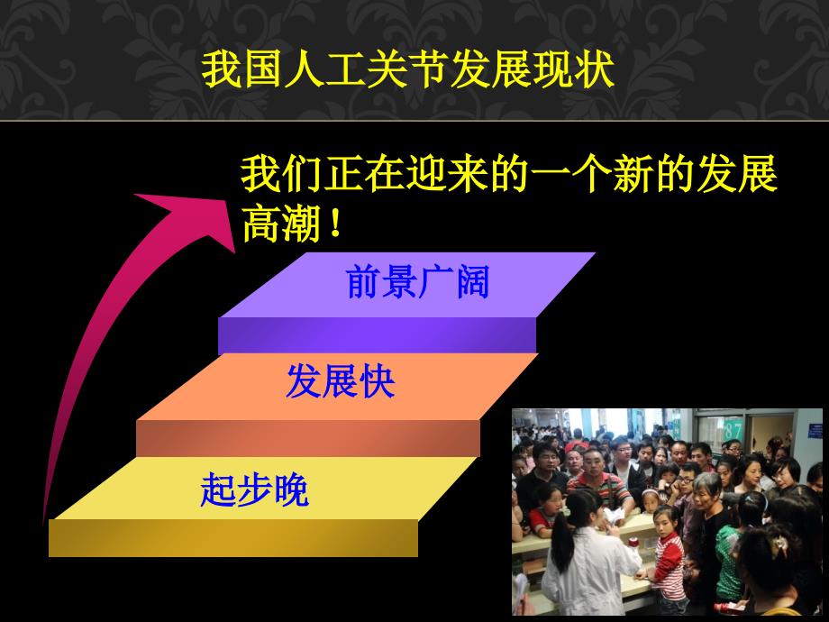 全膝关节置换术中下肢生物力线与截骨问题的探讨教程文件_第4页