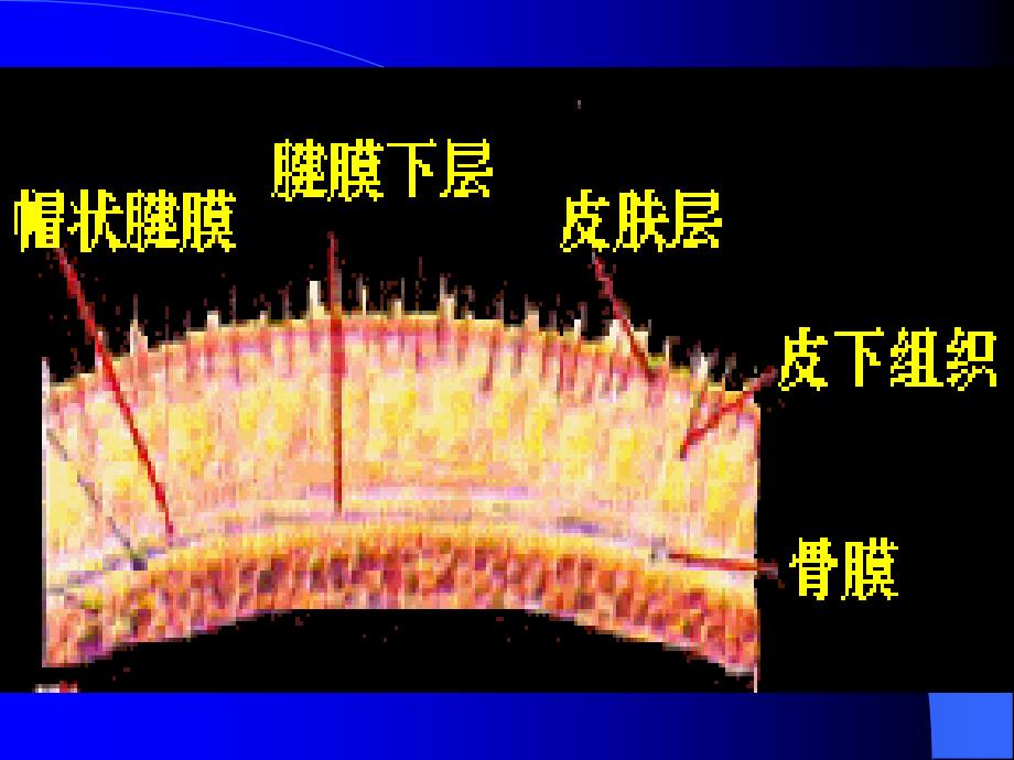 脑损伤---卡和曼(1)备课讲稿_第3页