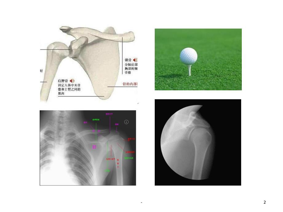 外科学(关节脱位)-ppt课件_第2页