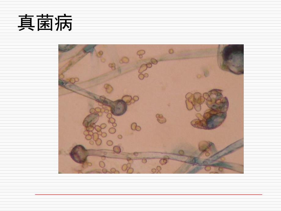 皮肤病实验室检查ppt课件_第4页