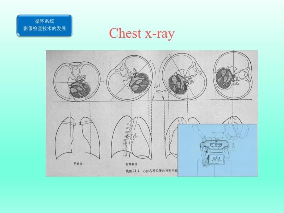 《医学影像学 》课件：本科循环系统大课（2016年修订）_第5页