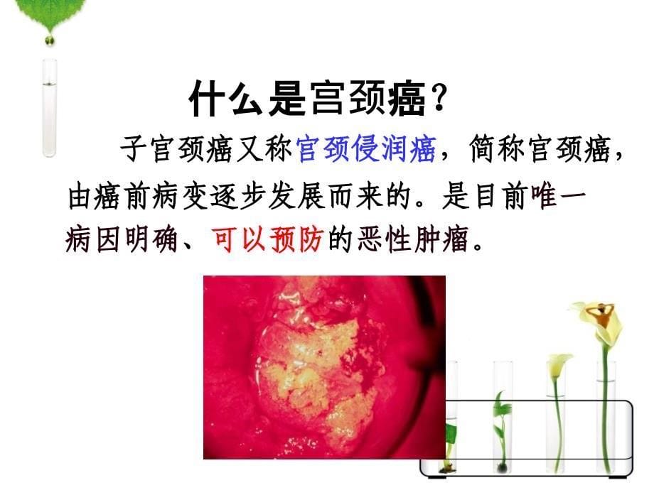 张和平课件：HPV感染与宫颈癌_第5页