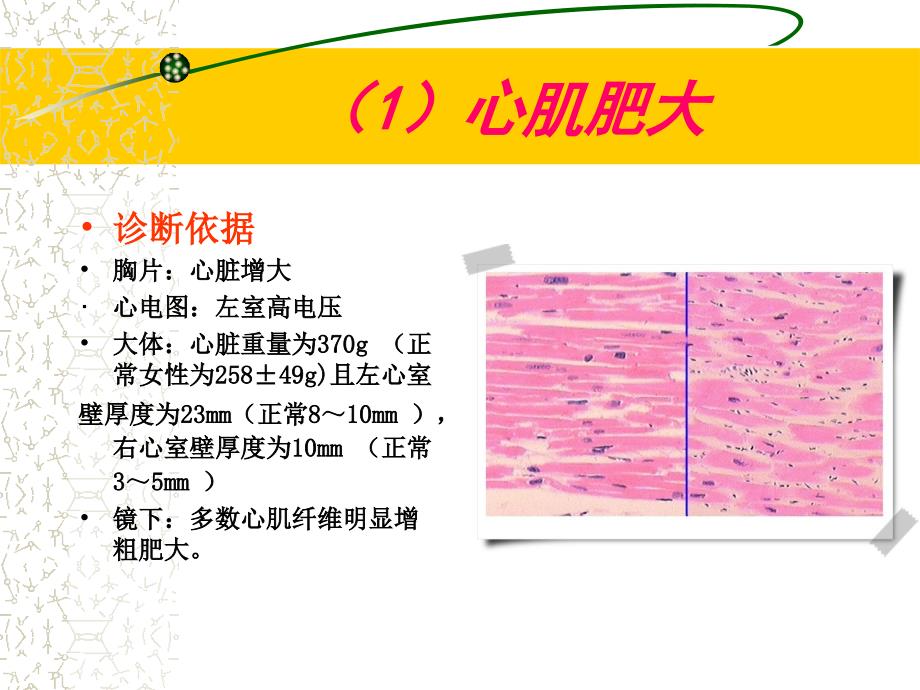 炎症病例讨论PPT课件_第4页