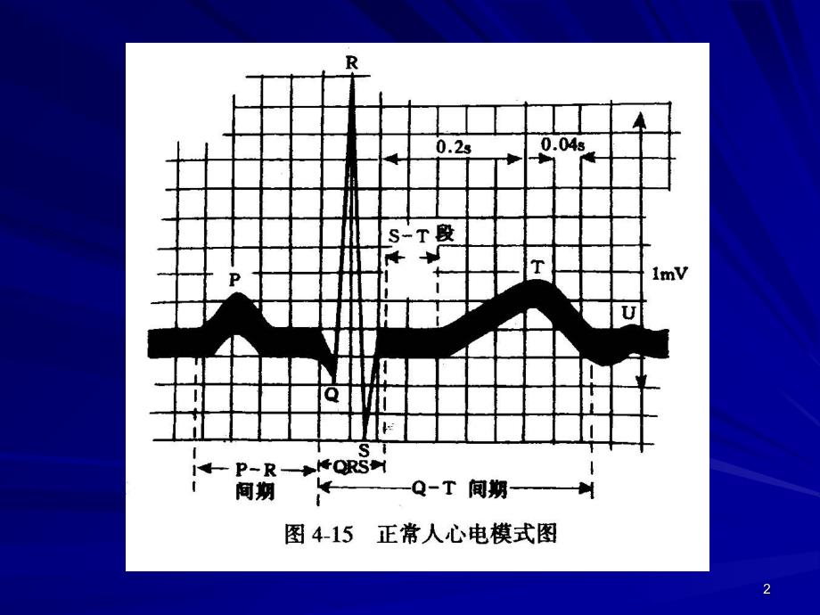 四体表心电图_第2页