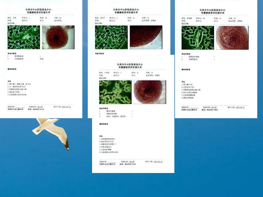 超高倍显微分析检测结果分析及图库病例分析ppt课件_第3页